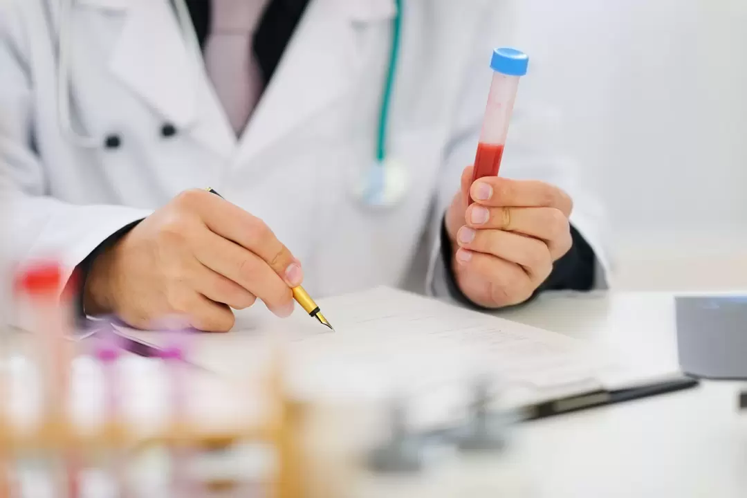 esame del sangue per i parassiti