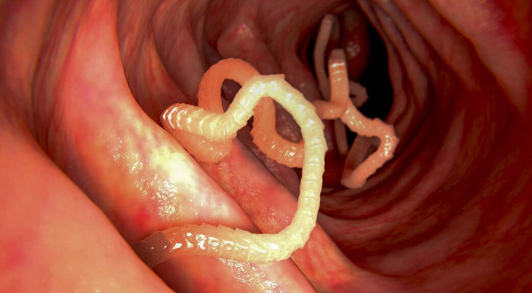 diagnosi di parassiti nell'intestino