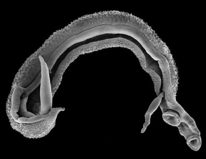 schistosoma dal corpo umano
