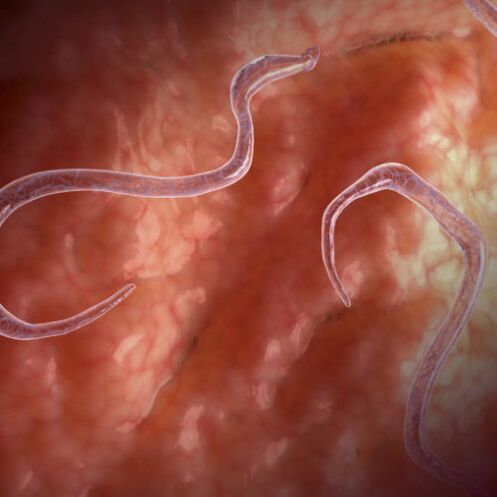 Parassiti nell'intestino
