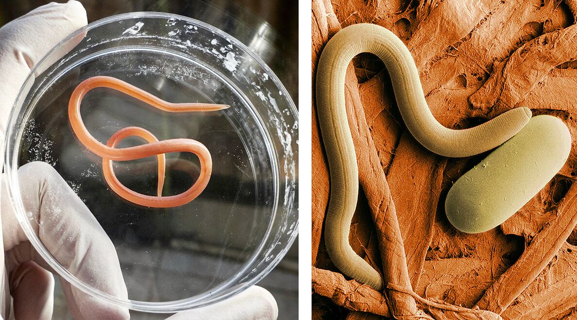 parassiti nel corpo umano