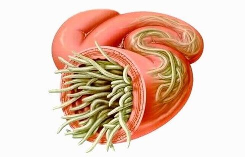 i vermi sono parassiti dell'intestino umano