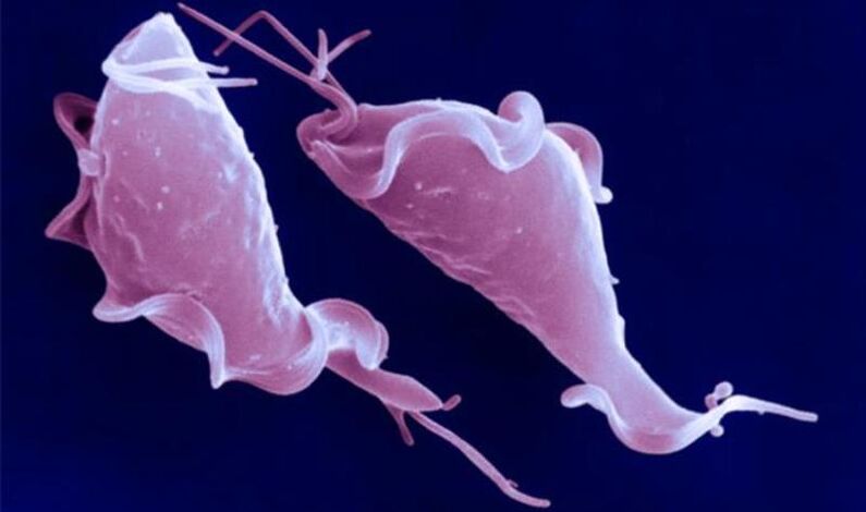 Il Trichomonas vaginalis è un parassita protozoario che provoca infertilità.